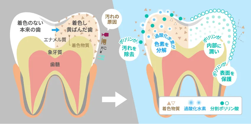 ホワイトニングイメージ
