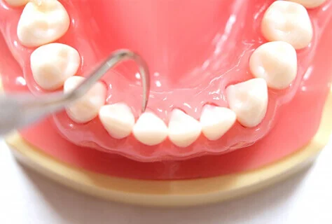 予防処置イメージ